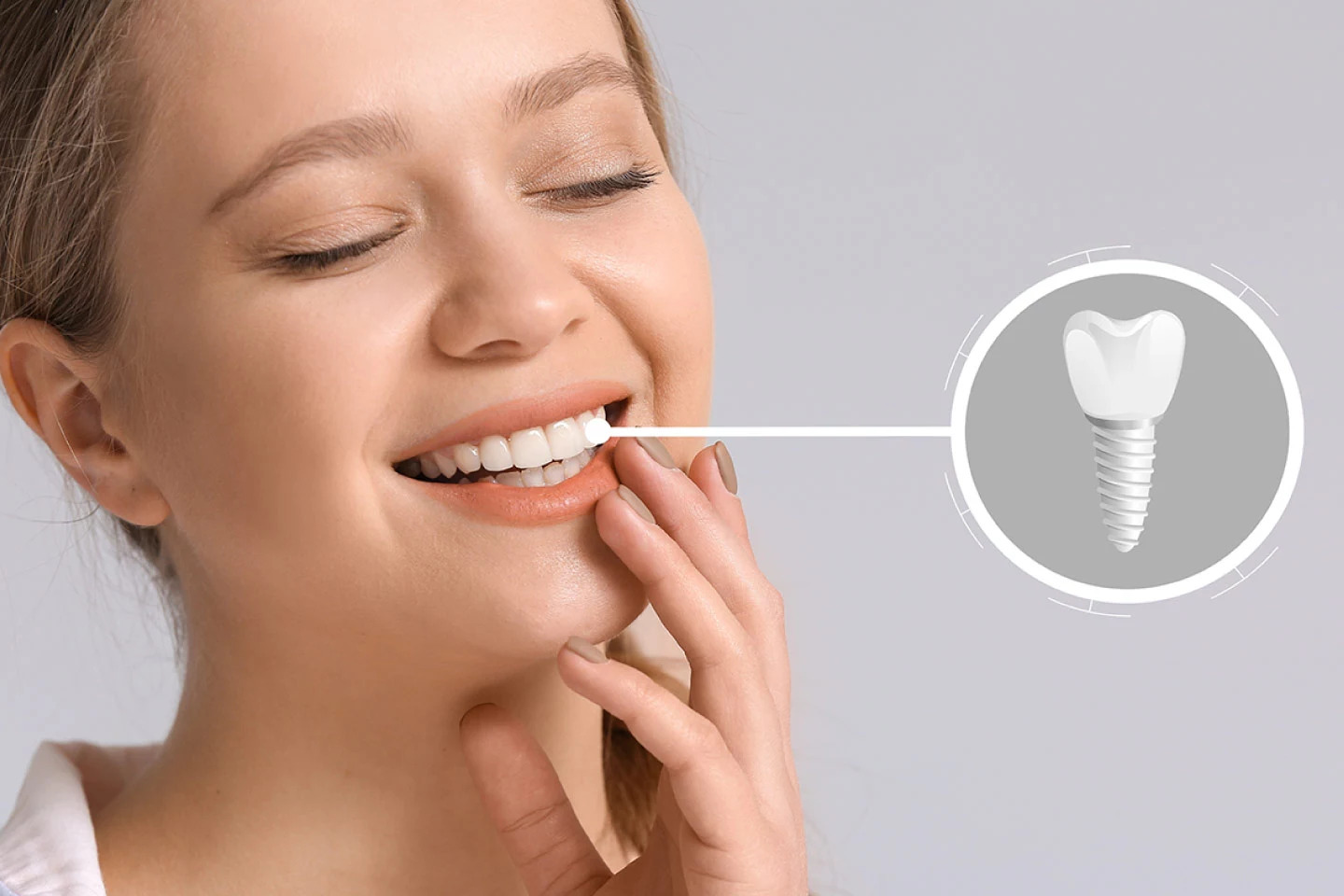 Implants - Dr. Sunit Jain Dental Care