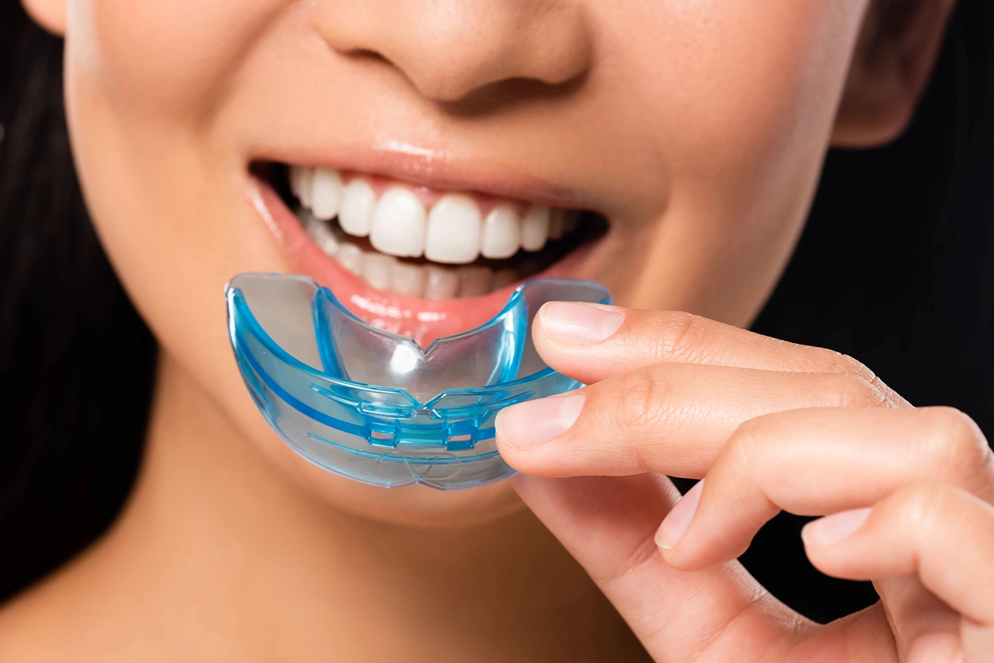 Mouthguards - Dr. Sunit Jain Dental Care
